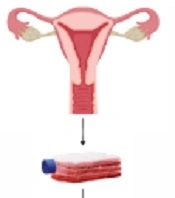Extracellular Vesicles Isolated from Menstrual Blood-derived Mesenchymal Stem Cells in Regenerative Medicine