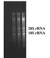 The Act of Diminishing the RTRAF Expression in Benign Thyroid Tissues Represents a Potential Method for Impeding the Progression of Malignancy in Cells