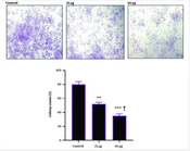 Suppressing Effect of Human Wharton’s Jelly Mesenchymal Stem Cell Secretomes on Oxidative Stress Induced by Breast Cancer Cell Line SK-BR3