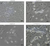 Synergistic Effect of Lovastatin and Selegiline on the Differentiation of Bone Marrow Stromal Cells Into Neuron-Like Cells