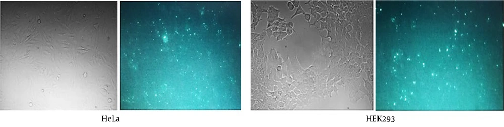 Fluorescence microscopy of transfected cells showed an acceptable transfection efficiency of hypoxia-inducible factor 1α (HIF1α) small interfering ribonucleic acid (siRNA) after 24 h. Fluorescence microscopy of transfected cells showed an acceptable transfection efficiency of hypoxia-inducible factor 1α (HIF1α) small interfering ribonucleic acid (siRNA) after 24 h.