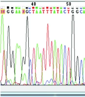 Cover image of the article: Investigation of TMEM70 Gene Mutations Involved in Mitochondrial ATP Synthesis Pathway in Two Khuzestan Families