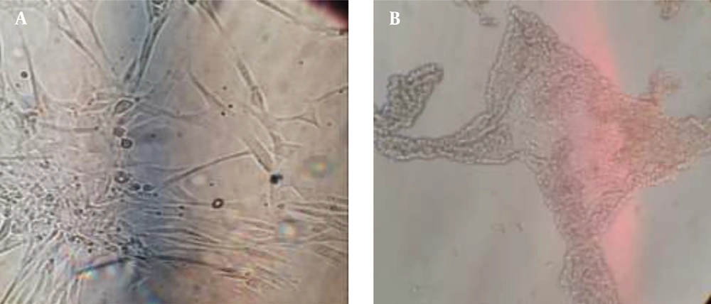 A, microphotographs of human fibroblasts; and B, MCF-7 human breast cancer cell line A, microphotographs of human fibroblasts; and B, MCF-7 human breast cancer cell line