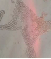 Cytotoxic Effect of Aqueous Extract of Sweet Pomegranate Seed and Vitamin D on MCF-7 Human Breast Cancer and Human Fibroblast Cell Lines