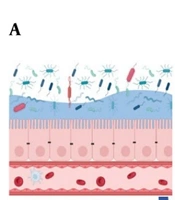 Enterotype 3-Driven Gut Dysbiosis: A Primary Pathway to Systemic Inflammation and CNS Autoimmunity in Multiple Sclerosis