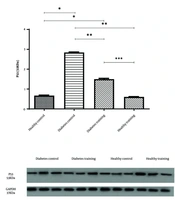 High-Intensity Interval Training Attenuates Cardiac P53–p21 Stress Signaling in a Mouse Model of Type 2 Diabetes