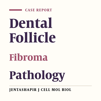 Multiple Calcifying Hyperplastic Dental Follicles: A Case Report