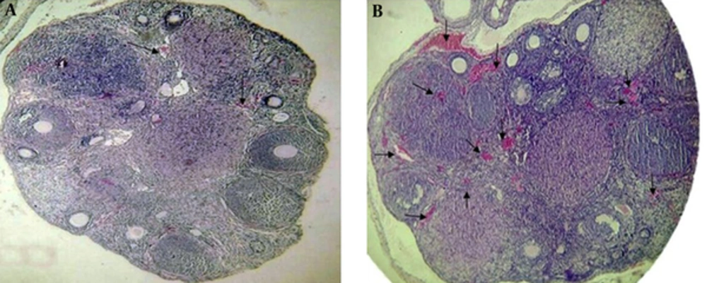 Representative comparison of vascular density and intravascular area of the ovarian tissue between the control and test groups after treatment of <i>S. officinalis</i> with a light microscopy, magnification was × 400. There was a significant difference in vascular density between the control and test groups, (P ≤ 0.05). A significant difference was also observed in the intravascular area between the control and test groups at the preimplantation time. Arrows show the vascular section in each group. A, Vascular density and intravascular area in the control group. B, Vascular density and intravascular area in the test group. Representative comparison of vascular density and intravascular area of the ovarian tissue between the control and test groups after treatment of <i>S. officinalis</i> with a light microscopy, magnification was × 400. There was a significant difference in vascular density between the control and test groups, (P ≤ 0.05). A significant difference was also observed in the intravascular area between the control and test groups at the preimplantation time. Arrows show the vascular section in each group. A, Vascular density and intravascular area in the control group. B, Vascular density and intravascular area in the test group.