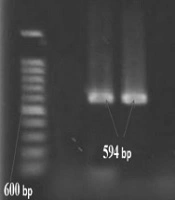 Frequency of qnr and aac(6’)Ib-cr Genes Among ESBL-Producing Klebsiella pneumoniae Strains Isolated from Burn Patients in Kermanshah, Iran