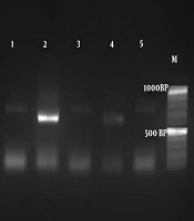 Oral Candidiasis in Hematological Malignancy Patients: Identification and Antifungal Susceptibility Patterns of Isolates