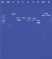 Cover image of the article: Modified and Improved DNA Extraction Method for Molecular Detection of Candida Species from Positive Blood Culture Bottles