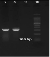 Downregulation of miR-143/145 Cluster in Breast Carcinoma Specimens: Putative Role of DNA Oncoviruses