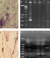 Competency Assessment: Diagnostic Methods for Detection of Cryptosporidium, Microsporidia, and Toxoplasma in Bronchoalveolar Lavage Samples