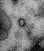 Efficacy of Phage-Antibiotic Combinations Against Multidrug-Resistant Klebsiella pneumoniae Clinical Isolates