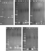 Isolation of the Bacteriophages Inhibiting the Expression of the Genes Involved in Biofilm Formation by Streptococcus mutans
