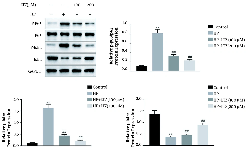 Ligustrazine attenuated <i>Helicobacter pylori</i>-induced NF-κB activation in GES-1 cell line. Ligustrazine treatment decreased <i>H. pylori</i>-induced protein expression of IκBα, and increased protein expression of the phosphorylation of p65 in GES-1 cell line. ** Vs. control, P < 0.01. ## Vs. <i>H. pylori</i>, P < 0.01. Ligustrazine attenuated <i>Helicobacter pylori</i>-induced NF-κB activation in GES-1 cell line. Ligustrazine treatment decreased <i>H. pylori</i>-induced protein expression of IκBα, and increased protein expression of the phosphorylation of p65 in GES-1 cell line. ** Vs. control, P < 0.01. ## Vs. <i>H. pylori</i>, P < 0.01.