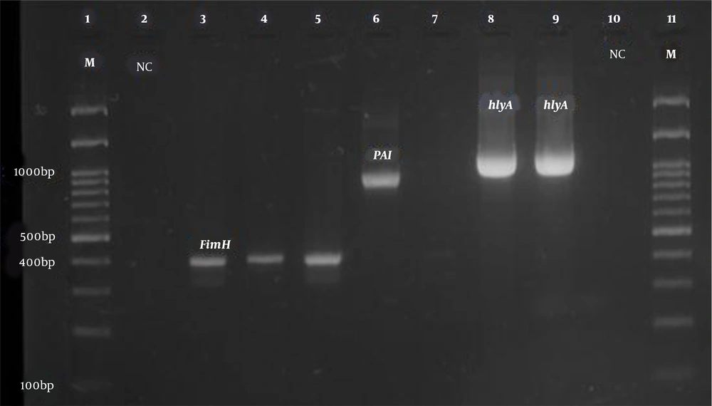 PCR product electrophoresis for <i>FimH</i>, <i>PAI</i>, and <i>hlyA</i> genes (Row M, marker 100 bp DNA ladder; Rows 3, 4, and 5, positive sample of <i>FimH</i> gene 400 bp; Row 6, positive sample of <i>PAI</i> gene 930 bp; Rows 8 and 9, positive sample of <i>hlyA</i> gene 1177 bp; Rows 2 and 10, negative control). PCR product electrophoresis for <i>FimH</i>, <i>PAI</i>, and <i>hlyA</i> genes (Row M, marker 100 bp DNA ladder; Rows 3, 4, and 5, positive sample of <i>FimH</i> gene 400 bp; Row 6, positive sample of <i>PAI</i> gene 930 bp; Rows 8 and 9, positive sample of <i>hlyA</i> gene 1177 bp; Rows 2 and 10, negative control).