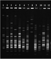 Identification of Enterococcus faecalis in Different Clonal Lineages with the Pulsed-Field Gel Electrophoresis Method in Imam Khomeini Hospital, Ilam, Iran