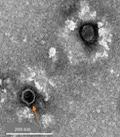 Isolation and Characterization of Bacteriophage Against Wastewater Isolates of Methicillin-resistant Staphylococcus aureus