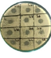 Occurrence of Hypervirulent Klebsiella pneumoniae in Clinical Settings and Lytic Potential of Bacteriophages Against the Isolates