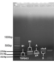 Distribution of Pathogenicity Island Markers and Virulence Factors Genes of Extraintestinal Pathogenic Escherichia coli Isolates