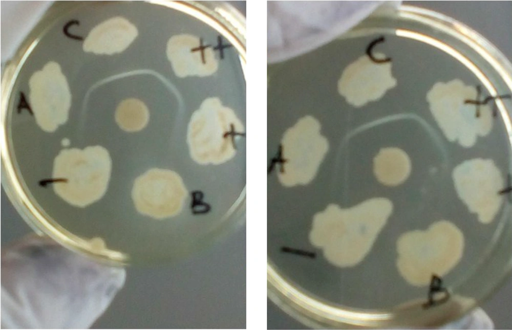Comparison of the results of the Elek test using the standard method (left side) and Columbia blood agar base (right side): high toxin positive control (++), weak toxin positive control (+), negative control (-), toxigenic samples (A and C), nontoxigenic sample (B). Comparison of the results of the Elek test using the standard method (left side) and Columbia blood agar base (right side): high toxin positive control (++), weak toxin positive control (+), negative control (-), toxigenic samples (A and C), nontoxigenic sample (B).