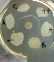 Columbia Blood Agar Base as an Alternative Medium for the Elek Test