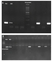 Evaluation of False Negative Among SARS-COV-2 Patients with Negative Real-time PCR Result Using Nested-RT PCR