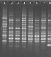 Prevalence of Plasmid-Mediated Quinolone Resistance Genes and Molecular Typing of Klebsiella pneumoniae Isolates from Blood Cultures in Milad Hospital, Tehran, Iran, Within 2018 - 2019