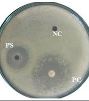 Drug-Resistant Proteus Virulence Factors Characterization and Their Inhibition Using Probiotic Bacteria