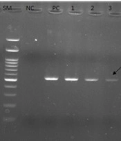 Changes of Gene Expression in Candida albicans Isolates from Vaginal Infections by Effects of Zinc Oxide Nanoparticles and Fluconazole