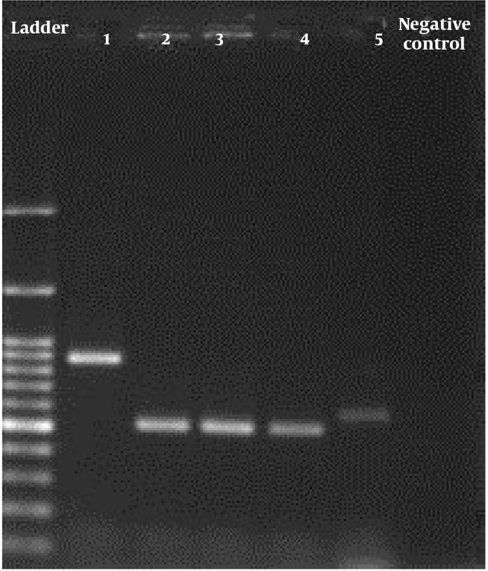 Agarose gel electrophoresis of PCR products of <i>Candida</i> spp. isolated from candiduria. From left: DNA ladder (100 bp), number 1: <i>C. glabrata</i>, number 2: <i>C. tropicalis</i>, number 3: <i>C.</i><i>parapsilosis</i>, number 4: <i>C. krusei</i>, number 5: <i>C. albicans</i>, and negative control. Agarose gel electrophoresis of PCR products of <i>Candida</i> spp. isolated from candiduria. From left: DNA ladder (100 bp), number 1: <i>C. glabrata</i>, number 2: <i>C. tropicalis</i>, number 3: <i>C.</i><i>parapsilosis</i>, number 4: <i>C. krusei</i>, number 5: <i>C. albicans</i>, and negative control.