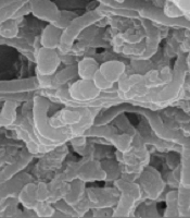 Evaluation of the Simultaneous Effects of Lactobacillus delbrueckii and L. lactis on Biofilms of Isolates from Chronic Ulcer Infections with Multiple-drug Resistance