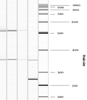 Prevalence of Genes Encoding Resistance to Aminoglycosides and Virulence Factors Among Intestinal Vancomycin-Resistant Enterococci