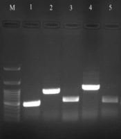 Detection of Extended-spectrum Beta-lactamases (ESBLs), Carbapenemase, Metallo-β-lactamase Production Bacteria and Antibiotic Susceptibility Pattern in Hospitalized Patients with Ventilator-associated Pneumonia