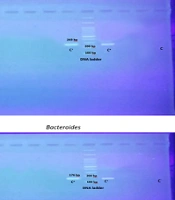 Comparison of Respiratory Microbiota in Patients with and Without Hospital-Acquired Infection