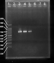 Increasing Antimicrobial Resistance of Gram-Positive Cocci in the Nostrils of Health Care Workers in the Post–COVID-19 Era Compared to Pre–COVID-19 Era in North Khorasan, Iran
