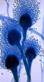 Investigating the Presence of Aspergillus fumigatus and A. flavus Using Galactomannan Enzyme Assay and TaqMan Real-Time PCR Technique