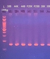 Fusobacterium nucleatum-Mediated Alteration in Expression of VEGF and CCL3 Genes and KRAS Mutation in Colorectal Cancer Patients