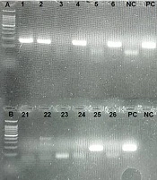 Detection of the SARS-CoV-2 Genome in Peripheral Blood Mononuclear Cells of Hospitalized Patients With COVID-19 Infection