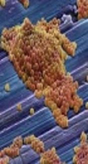 Regulation of saeRS, agrA and sarA on sasX Expression in Staphylococcus aureus