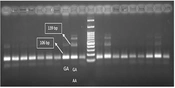 Association of IL-10 Gene in Protection Against COVID-19 Disease
