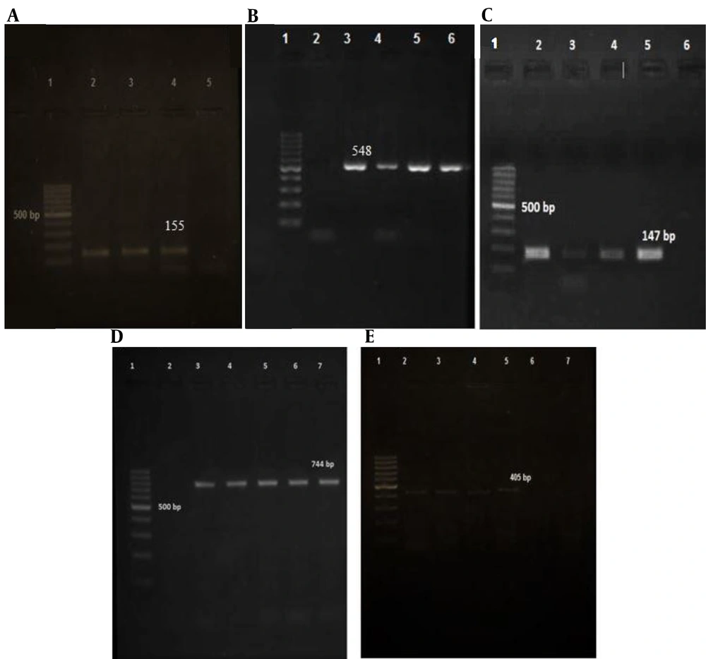 Analysis of PCR products by agarose gel electrophoresis of prophage typing. A: (SGF prophage); Lane 1: 100-bp DNA molecular weight marker, followed by positive control in lane 2, positive SGF sample (155 bp) in lanes 3 and 4, and negative control in lane 5. B: (SGFa); Lane 1: 100-bp DNA molecular weight marker, followed by negative control in lane 2, positive SGF sample (548 bp) in lanes 3 - 5, and positive control in lane 6. C: (SGFb); Lane 1: 100-bp DNA molecular weight marker, followed by positive control in lane 2, positive SGFba sample (147 bp) in lanes 3 - 5, and negative control in lane 6. D: (SGA); Lane 1: 100-bp DNA molecular weight marker, followed by negative control in lane 2, positive SGA sample (744 bp) in lanes 3-6, and positive control in lane 7. E: (SGB prophage); Lane 1: 100-bp DNA molecular weight marker, followed by positive control in lane 2, positive SGB sample (405 bp) in lanes 3 - 6, and negative control in lane 7. Analysis of PCR products by agarose gel electrophoresis of prophage typing. A: (SGF prophage); Lane 1: 100-bp DNA molecular weight marker, followed by positive control in lane 2, positive SGF sample (155 bp) in lanes 3 and 4, and negative control in lane 5. B: (SGFa); Lane 1: 100-bp DNA molecular weight marker, followed by negative control in lane 2, positive SGF sample (548 bp) in lanes 3 - 5, and positive control in lane 6. C: (SGFb); Lane 1: 100-bp DNA molecular weight marker, followed by positive control in lane 2, positive SGFba sample (147 bp) in lanes 3 - 5, and negative control in lane 6. D: (SGA); Lane 1: 100-bp DNA molecular weight marker, followed by negative control in lane 2, positive SGA sample (744 bp) in lanes 3-6, and positive control in lane 7. E: (SGB prophage); Lane 1: 100-bp DNA molecular weight marker, followed by positive control in lane 2, positive SGB sample (405 bp) in lanes 3 - 6, and negative control in lane 7.