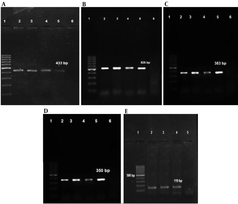 Analysis of PCR products by agarose gel electrophoresis of toxin genes: (A) <i>pvl</i> genes (433 bp), (B) <i>hlb</i> genes (525bp), (C) <i>sak</i> genes (383bp), (D) <i>tst</i> genes (350bp); (E) <i>eta</i> genes(119bp). Lane 1: 100-bp DNA molecular weight marker; lanes 2, 3, and 4: Positive samples; lane 5: Positive control; lane 6: Negative control. Analysis of PCR products by agarose gel electrophoresis of toxin genes: (A) <i>pvl</i> genes (433 bp), (B) <i>hlb</i> genes (525bp), (C) <i>sak</i> genes (383bp), (D) <i>tst</i> genes (350bp); (E) <i>eta</i> genes(119bp). Lane 1: 100-bp DNA molecular weight marker; lanes 2, 3, and 4: Positive samples; lane 5: Positive control; lane 6: Negative control.