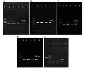 Jundishapur J Microbiol