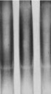 Arg677Trp and Arg753Gln Polymorphisms in <i>TLR2</i> Genes Detected in Patients With Tuberculosis in Golestan Province, Iran
