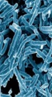 Co-Expression of hbha and mtb32C Genes from Mycobacterium tuberculosis H37Rv in a Prokaryotic System
