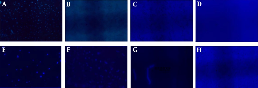 A, <i>Vibrio vulnificus</i> and DNA aptamer; B, <i>V. vulnificus</i>; C, <i>Escherichia coli</i> and DNA aptamer; D, DNA aptamer; E, <i>Enterococcus faecalis </i>and DNA aptamer; F, <i>Aeromona hydrophila</i> and DNA aptamer; G, <i>Streptococcus dysgalactiae</i> and DNA aptamer; H, <i>V. parahaemolyticus</i> and DNA aptamer. All the strains are detected under a fluorescence microscope A, <i>Vibrio vulnificus</i> and DNA aptamer; B, <i>V. vulnificus</i>; C, <i>Escherichia coli</i> and DNA aptamer; D, DNA aptamer; E, <i>Enterococcus faecalis </i>and DNA aptamer; F, <i>Aeromona hydrophila</i> and DNA aptamer; G, <i>Streptococcus dysgalactiae</i> and DNA aptamer; H, <i>V. parahaemolyticus</i> and DNA aptamer. All the strains are detected under a fluorescence microscope
