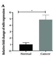 Associations Between Fusobacterium nucleatum and msh2, mlh1, and msh6 Gene Expression in Colorectal Cancer