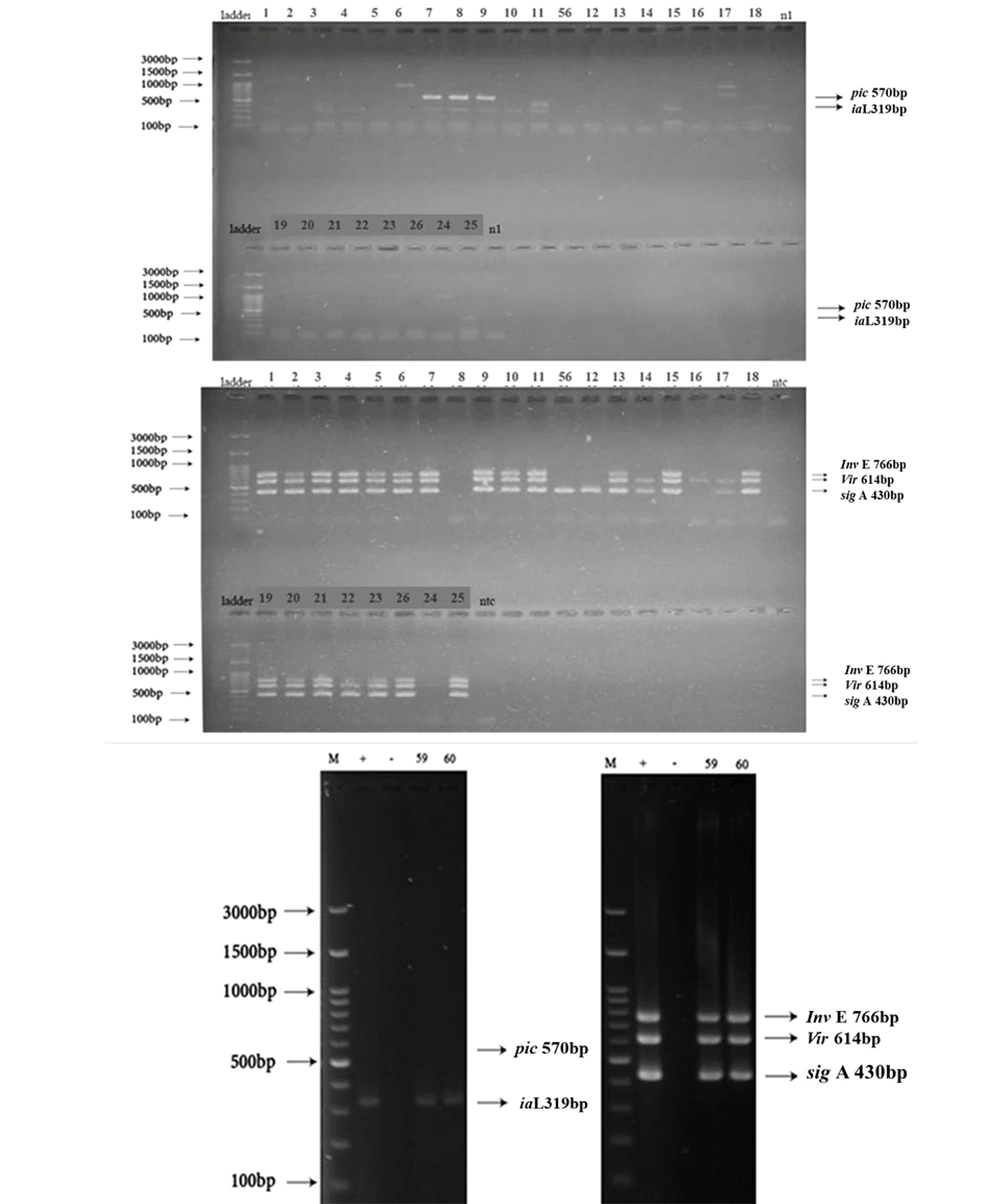 Multiplex PCR assay for detection of A, <i>pic</i> (570 bp) and <i>ial</i> (319 bp); B, <i>invE</i><i>(766 bp),</i><i>virF (614 bp)</i> and <i>sigA</i><i>(430 bp)</i>; and C, <i>pic</i> (570 bp), <i>ial</i> (319 bp), <i>invE</i> (766 bp), <i>virF</i> (614 bp) and <i>sigA</i> (430 bp) on 1.5% agarose gel. First lane: marker (100 bp), Lane 1, 2, 3, 4, 5, 6, 7, 8, 9, 10, 11, 56, 12, 13, 14, 15, 16, 17, 18, 19, 20, 21, 22, 23, 26, 24, 25, 59, 60, extracted DNA of <i>Shigella</i> isolate. Multiplex PCR assay for detection of A, <i>pic</i> (570 bp) and <i>ial</i> (319 bp); B, <i>invE</i><i>(766 bp),</i><i>virF (614 bp)</i> and <i>sigA</i><i>(430 bp)</i>; and C, <i>pic</i> (570 bp), <i>ial</i> (319 bp), <i>invE</i> (766 bp), <i>virF</i> (614 bp) and <i>sigA</i> (430 bp) on 1.5% agarose gel. First lane: marker (100 bp), Lane 1, 2, 3, 4, 5, 6, 7, 8, 9, 10, 11, 56, 12, 13, 14, 15, 16, 17, 18, 19, 20, 21, 22, 23, 26, 24, 25, 59, 60, extracted DNA of <i>Shigella</i> isolate.